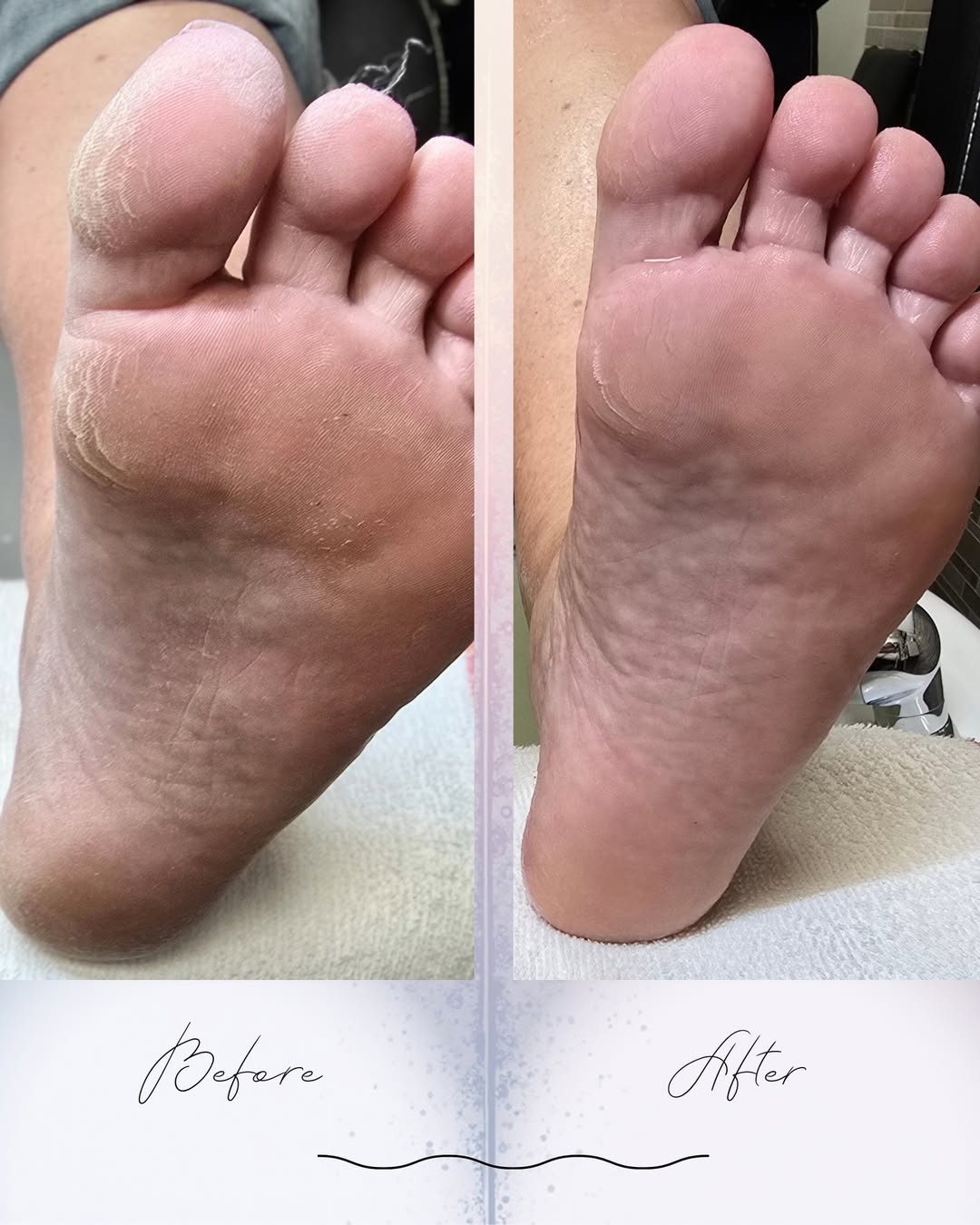 Feet before and after a foot-care treatment at Radiance Beauty Bar